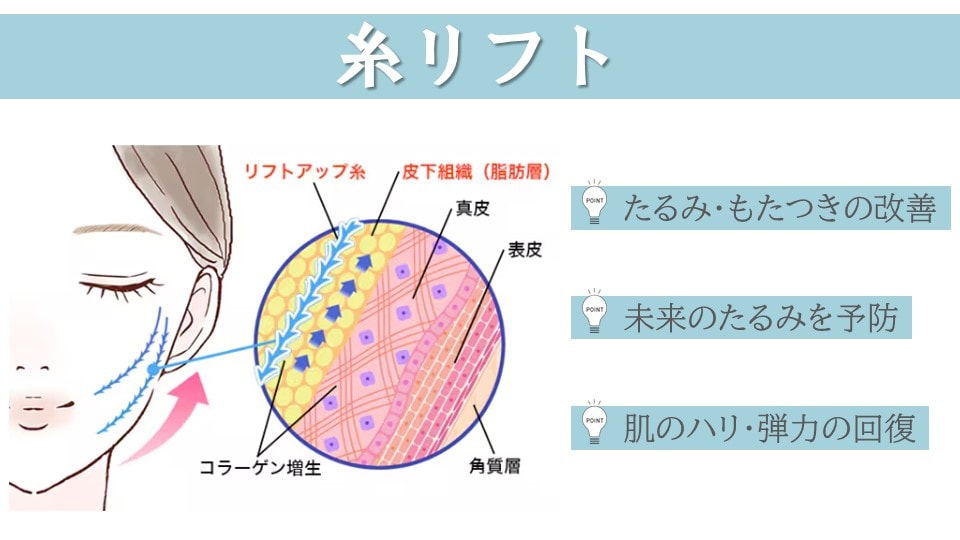 実はこれも肌育治療の仲間！？